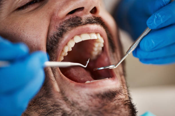 Best Emergency Dental Services for Seniors in Memphis, TN