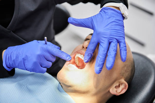 Best Emergency Dentist for Lost Fillings or Crowns in Memphis, TN