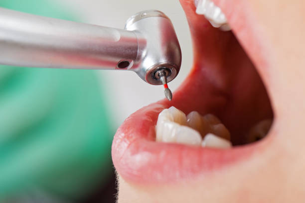 Best Weekend Emergency Dentist in Memphis, TN
